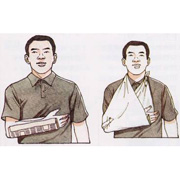 手臂骨折急救方法