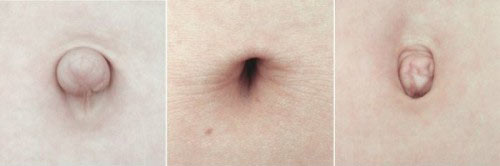 肚脐的位置能预测运动天赋?